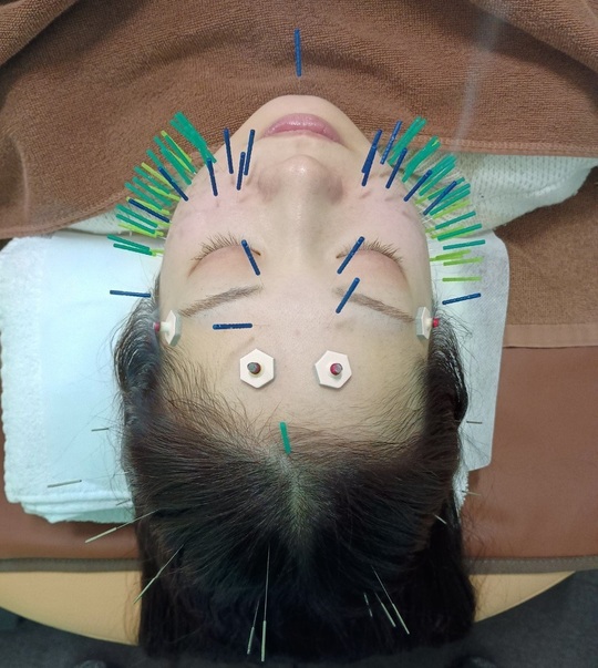 LEDコラーゲンマシン│青葉鍼灸接骨院 - 札幌市中央区で美容鍼灸・鍼灸